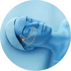 EMface facial toning London - 3D head diagram showing the upper cheeks 3D head diagram showing the upper cheeks for EMface facial toning in London